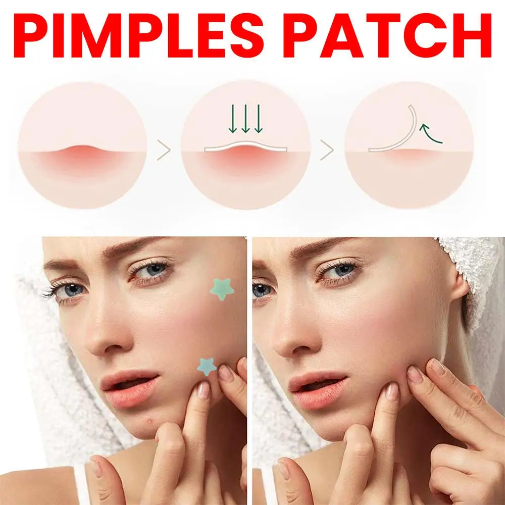 Pimple Patch Acne Colorful Acne Removal Skin Care Stickers